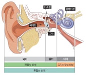 치과 진료 영역에서의 소음성 난청
