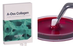 오스템임플란트 ‘A-Oss Collagen’ 인기