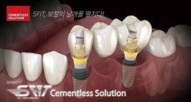코웰메디 ‘SFIT’ 시스템 관심 증대