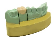 큐브세븐틴, 원격 임시치아 서비스에 관심