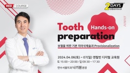 “Tooth Preparation의 모든 것”
