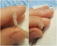 임신 14주 사산 태아 사진은 무엇을 노렸나