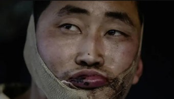 우크라에 생포된 북한군 포로, 한국 귀순 가능할까