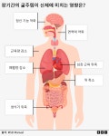 가자 지구: 장기간의 굶주림이 신체에 미치는 영향은