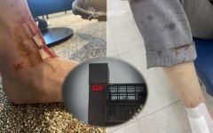 [단독] 황당한 CGV  … 화장실 문 무너져 피 철철 15만원+영화티켓 2장 보상