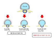목 디스크...원인과 증상
