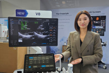 삼성, KIMES 2023 참전…AI 진단 보조기능 탑재한 최신 의료기기 전시