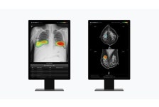루닛, ECR 2024서 연구초록 5편 공개 