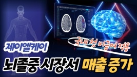 [이슈]제이엘케이 뇌경색 진단 AI기기 첫 비급여 적용...뇌졸중 시장서 매출 증가 기대