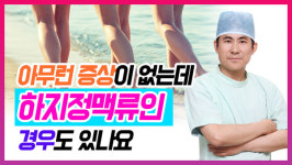 [영상] 아무런 증상이 없는데 하지정맥류인 경우도 있나요?