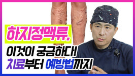 [영상] 하지정맥류 이것이 궁금하다! 치료부터 예방법까지