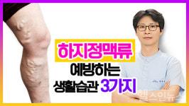 하지정맥류를 예방하는 생활습관 3가지 [영상]