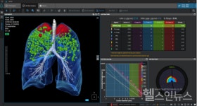코어라인소프트, 유럽 대형 병원·영상센터에 솔루션 공급 계약 체결
