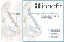 [의료기기업계 소식] 8월 30일