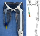 국립암센터 정형외과 의공학연구소, 대한3D프린팅융합의료학회 우수구연상 금상 수상
