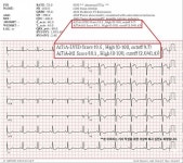 운암한국병원, AI 심전도 분석 솔루션 에티아로 급성 심근경색 조기 발견