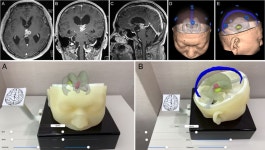 글로벌 시장에 메디컬 메타버스 첫 선...인공지능 의료영상 플랫폼 기업 메디컬아이피, 이목 집중!