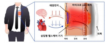 몸속 헬스케어 기기에 빛으로 전기 공급하는 에너지 패치 나왔다
