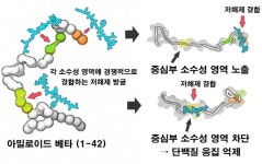 알츠하이머 유발 단백질 형성과정 규명…치료제 개발 실마리