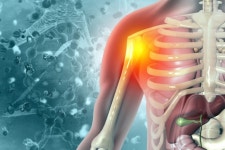 장내미생물, 원인 불명 만성통증 치료 효과 확인