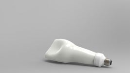 [신태운 원장의 치아건강] 임플란트 시술 후 나사가 부러졌다면?