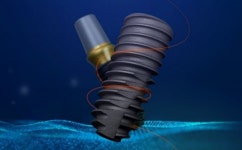 [生기업TALK] 이가 없으면 잇몸? 글로벌 덴트리스트의 One Pick 오스템임플란트 