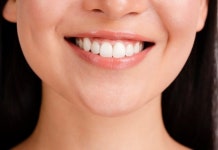 [신태운 원장의 치아건강] 자가치아미백제, 이렇게 사용하면 부작용 위험↑