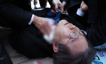 野이재명, 부산서 흉기피습… 정치권 피습 수난사 재조명