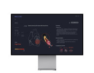 메디웨일, AI 심혈관 위험 예측 닥터눈 연세의료원 세브란스병원에 공급