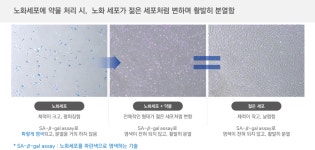 로노 식품영업소 | [인터뷰] 로노, 세포 노화 되돌리는 '세포 역노화 기술'로 신약∙화장품∙식품 개발