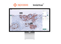 슈파스, 형태 계측 AI 솔루션 이니스뷰 식약처 허가 획득