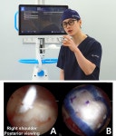 위라이브병원, 국내 최초 리제네텐 임상논문 발표… 회전근개 부분파열 치료 새 지평 열어