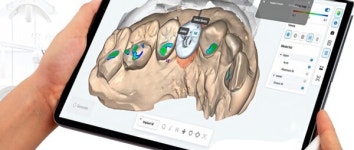 하스, 환자 맞춤형 AI 보철 디자인 플랫폼 AMDC 출시