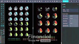 제이엘케이, JLK-CTP 미국 FDA 인허가 신청