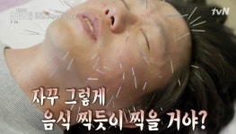 42세 성시경, 동안침 고슴도치 비주얼 “내 돈내고 맞아” 온앤오프 [결정적장면]