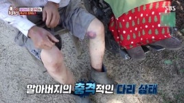 다리가 피멍에 상처 투성이…수탉 천생이, 주인 할아버지만 공격하는 이유(TV동물농장)