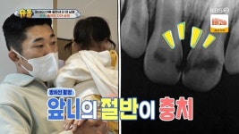 김동현 子 단우, 충격 치아 상태 “앞니 절반 충치, 녹아내려”(슈퍼맨)