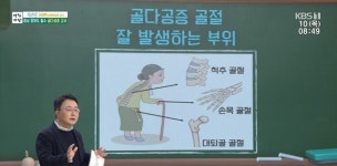 이재혁 교수 “골다공증, 골절 후 사망률 높아져”(아침마당)