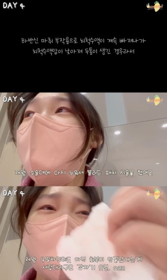 ‘최연소 아나’ 김수민, 출산 후 하반신 마취 부작용 해명 “이제 안 아파요”