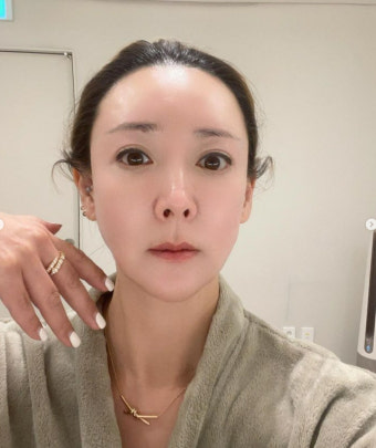 이상아, 두피+짝눈 이어 또 수술? “슬슬 견적이 나오네요”