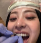 르세라핌 허윤진 ‘팬츠리스 룩’→치아 큐빅 ‘투스젬’+배꼽 피어싱‥파격 행보