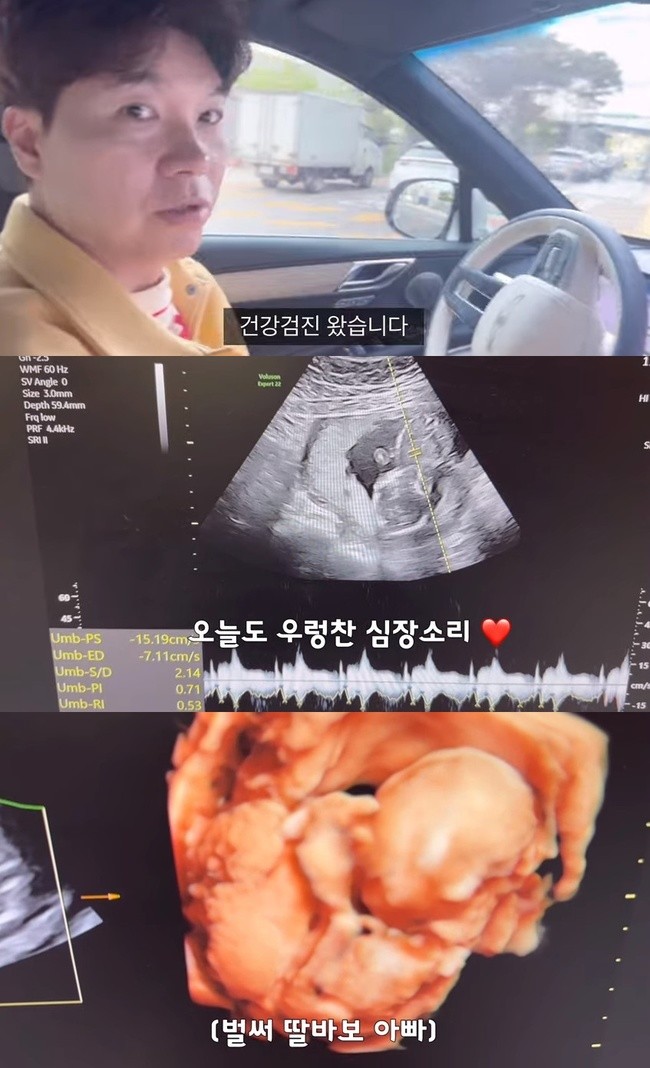 슈퍼맨이 돌아왔다 김다예, 건강에 적신호…70대 할머니 수준의 충격적인 결과