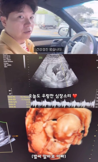 박수홍 벌써부터 딸바보 모드, 16주 태아에 “이목구비 예뻐” (행복해다홍)