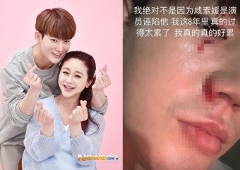 진화 “함소원 망치지마” 셀프 불화설 누구 탓, 피투성이 얼굴+저격 이유는 쉿[이슈와치]