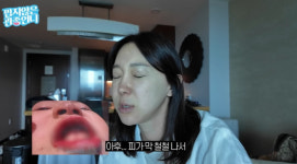 이지혜 딸 태리, 하와이서 잇몸 찢어져 피 철철 “2시간 지혈”