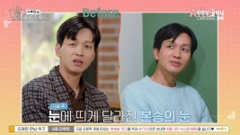 구본승, 처진 눈=필러 부작용 고백‥주사 시술로 멀쩡해진 근황(오만추)[결정적장면]