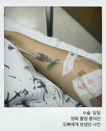 ‘암투병 고백’ 이솔이, 항암 후 머리 민 사진 공개 “박성광이 도토리 같다고”