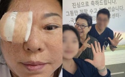 양희은, 각막이식 수술 후 반가운 소식 “덕분에 씩씩하게 견뎌냈어요”