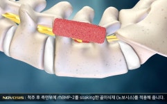 [비즈人워치]시지메드텍은 마지막 퍼즐…1.3조 매출 목표