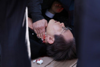 [속보]  이재명, 부산 방문 중 피습 당해… 용의자 현장 검거